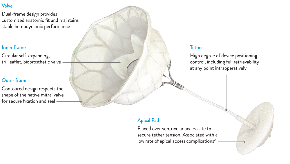Official Abbott labelled graphic of the Tendyne mitral valve parts
