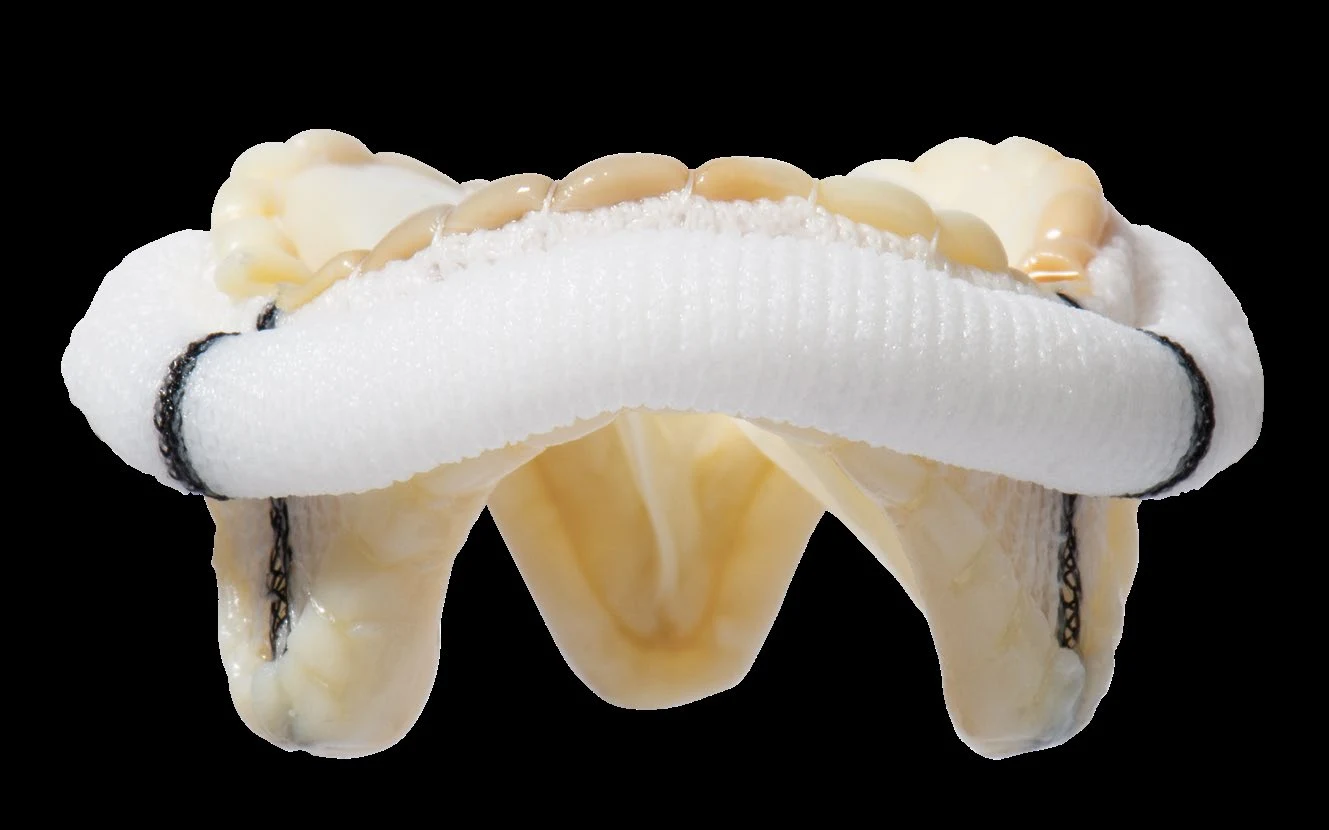 Epic™ Plus Mitral and Aortic Stented Tissue Valves